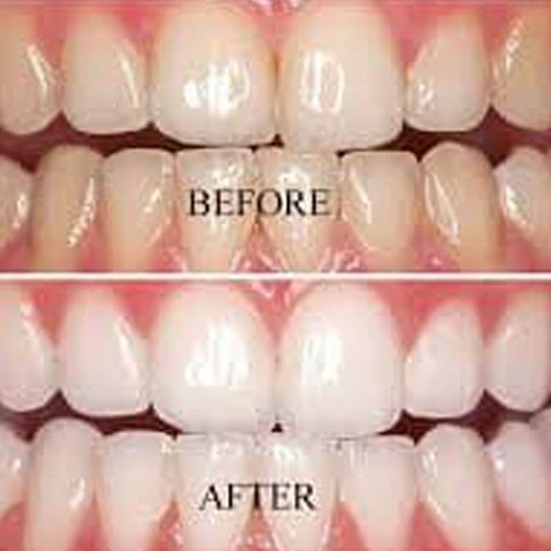 Advance Dental Care Consultants Clinic - Image 3